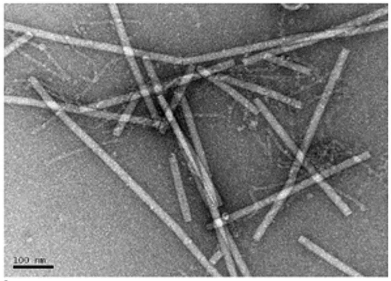 Archive electron micrograph showing rod-shaped ToBRFV particles